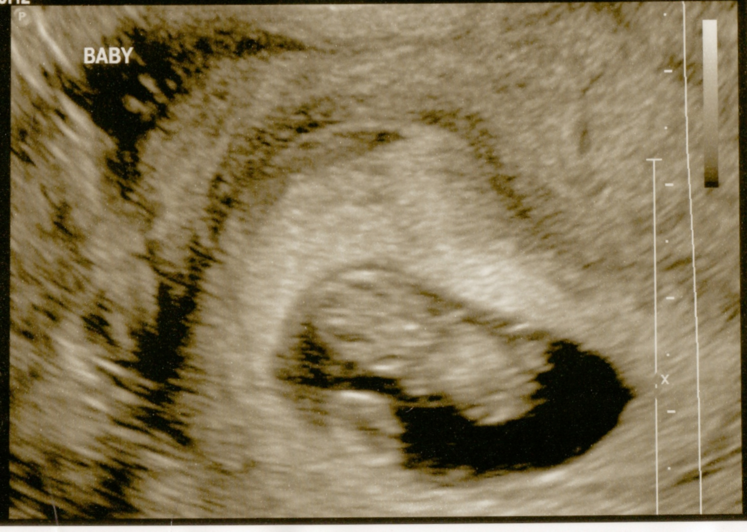 baby8halfweeks